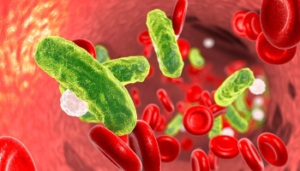 عفونت سپسیس چیست؟