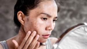 لیپودیستروفی چیست؟